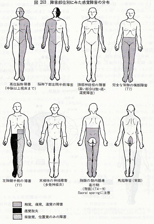 一般外来でみるしびれをどう考えるか 齋藤豊和先生 | 川村内科